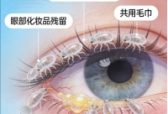 眼表健康新警示：反复眼干眼痒需警惕！蠕形螨检查成眼表精准诊疗关键