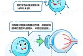 孩子近视戴眼镜运动不方便？上海爱尔浦亮眼科详解OK镜怎么选