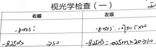 ​八百度近视少女终摘镜，南昌爱尔卢恒松助力奔赴大学新征程